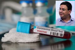 Infectologista da Unesp de Botucatu esclarece dúvidas sobre coronavírus