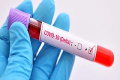 Com caso confirmado da Variante Delta de covid-19 em Botucatu, Secretaria de Saúde alerta sobre prevenção