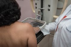Secretaria de Saúde oferece mamografias gratuitas para mulheres acima do 40 anos 