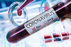 Paciente de Conchas é o sétimo caso de morte por infecção de coronavírus em Botucatu